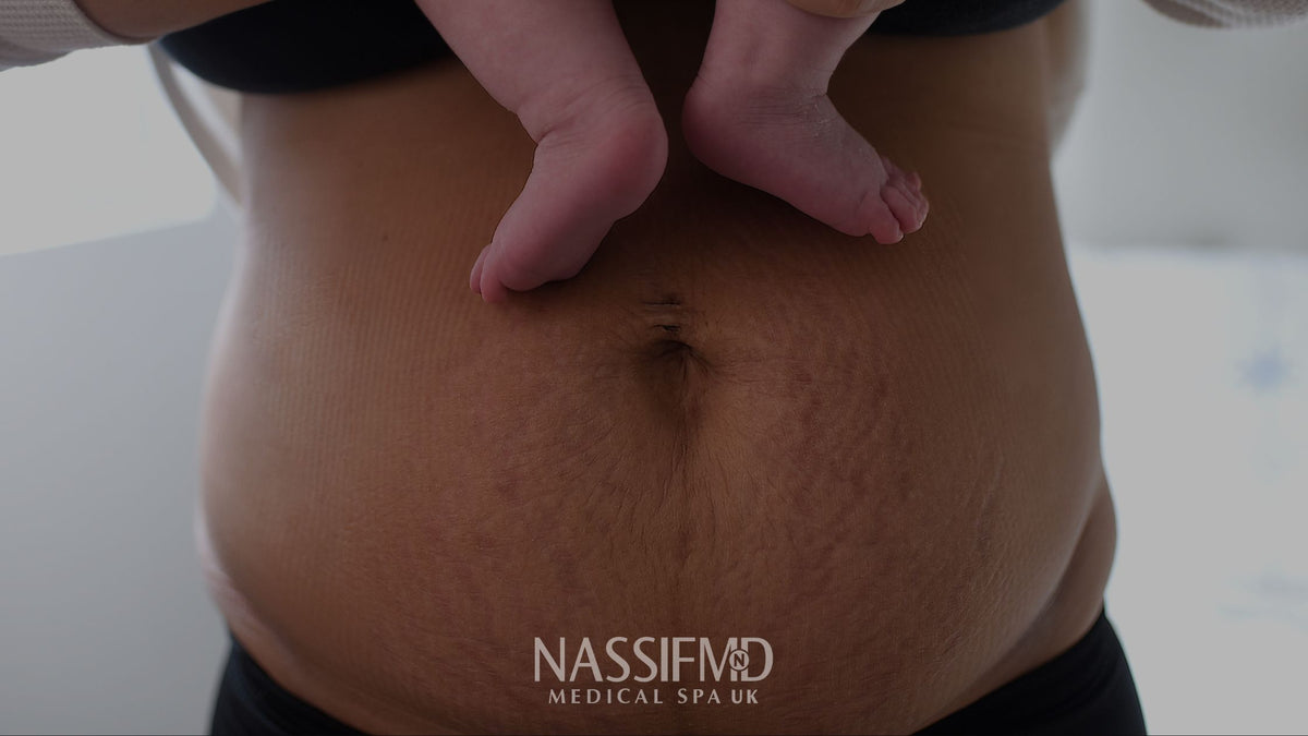Postpartum skin treatment for dryness and pigmentation Manchester