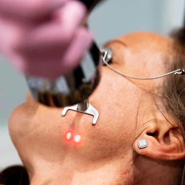 Laser resurfacing options for skin rejuvenation at NassifMD Manchester