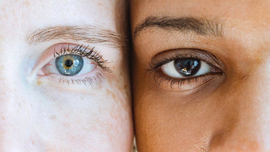 Laser treatment for pigmentation and sun damage in Manchester