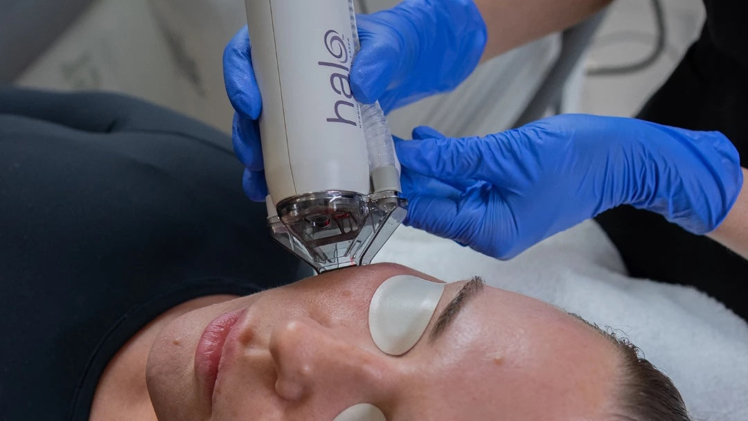 Sciton HALO laser handpiece on the cheek during a laser resurfacing treatment at NassifMD Medical Spa Manchester