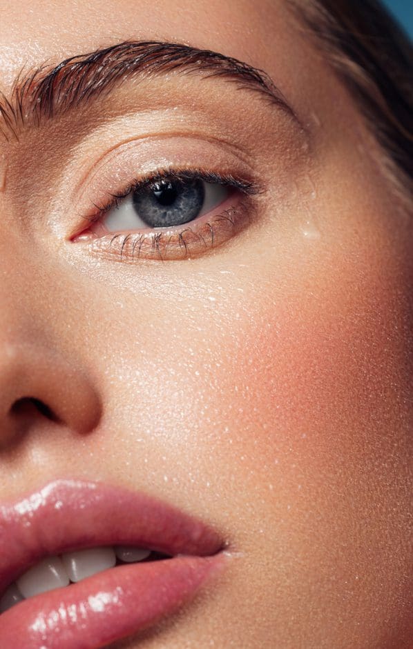 Tear trough filler treatment for under-eye hollows in Manchester