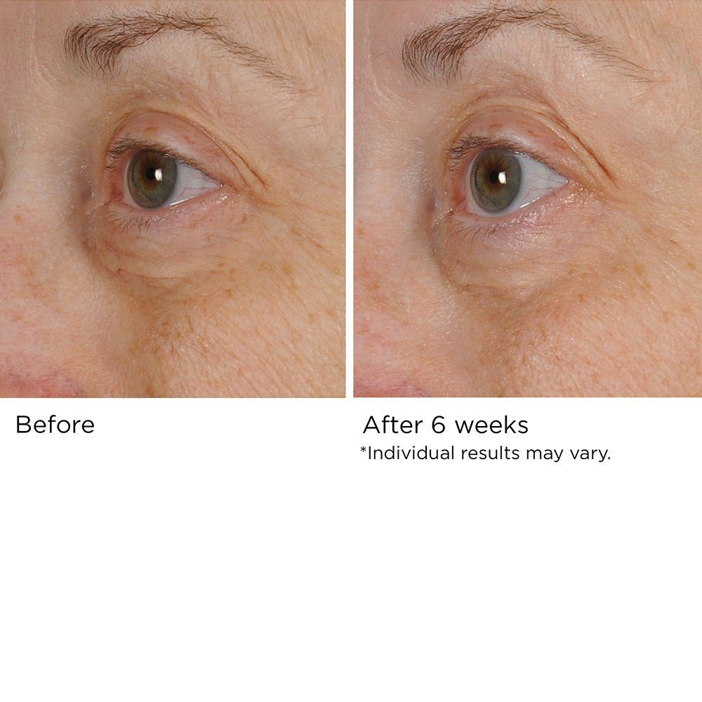PERI-ORBITAL COMPLEX REVITALIZING EYE CRÉME