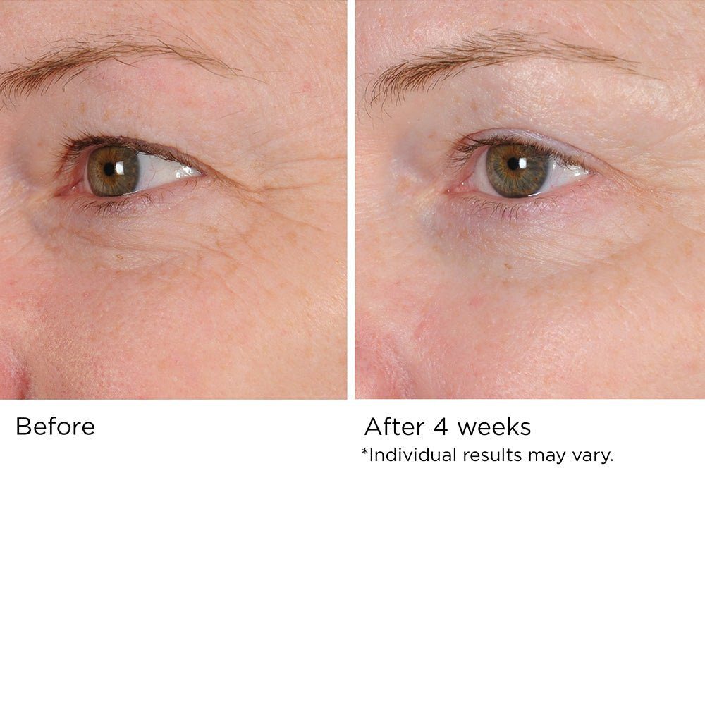 PERI-ORBITAL COMPLEX REVITALIZING EYE CRÉME