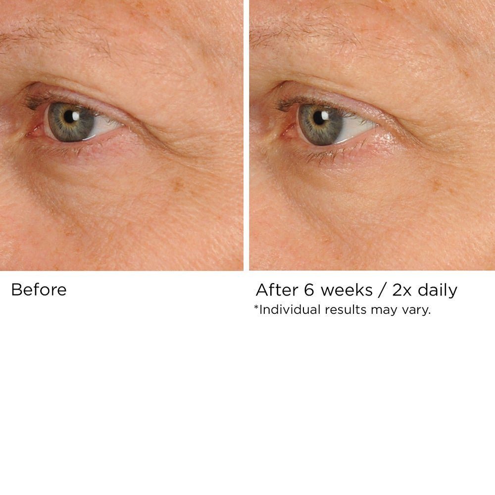 NassifMD Peri-Orbital eye cream ingredients list