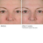 PERI-ORBITAL COMPLEX REVITALIZING EYE CRÉME