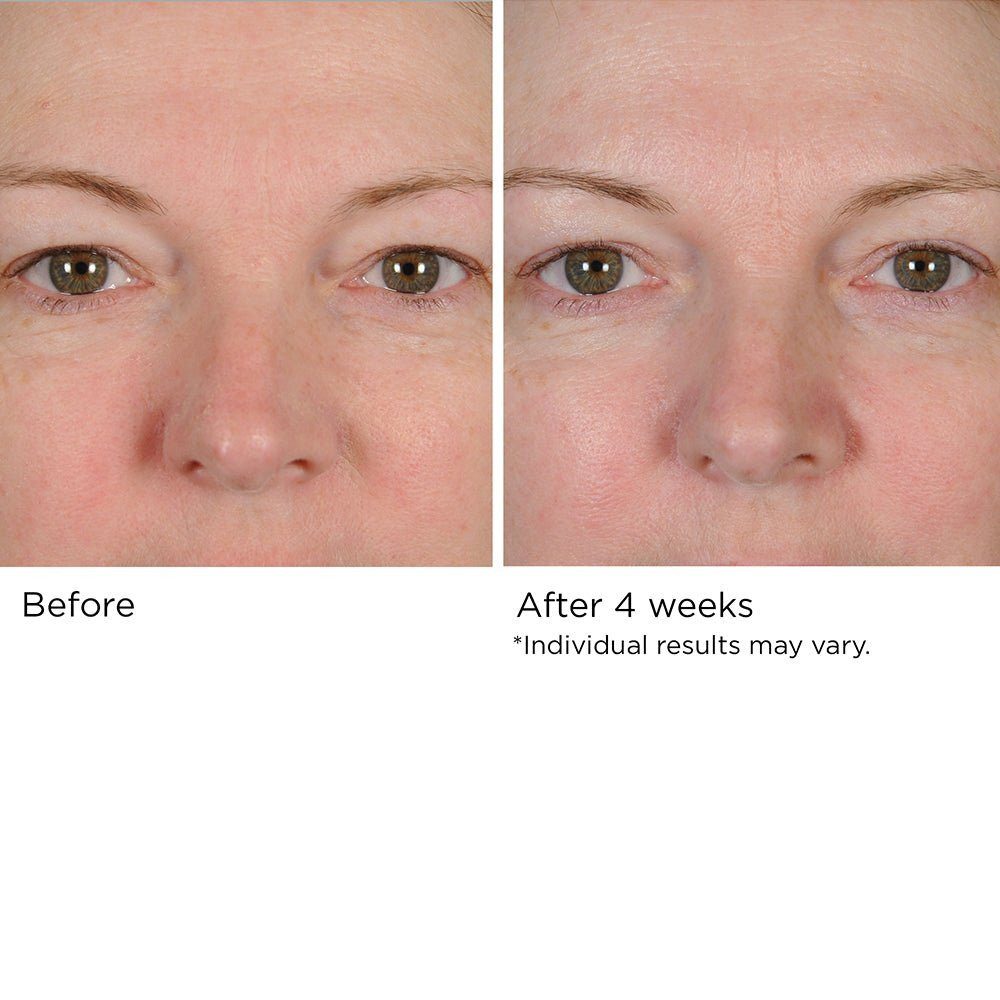 PERI-ORBITAL COMPLEX REVITALIZING EYE CRÉME