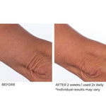 CREPE INHIBITOR TRIPLE ACTION BODY BUTTER