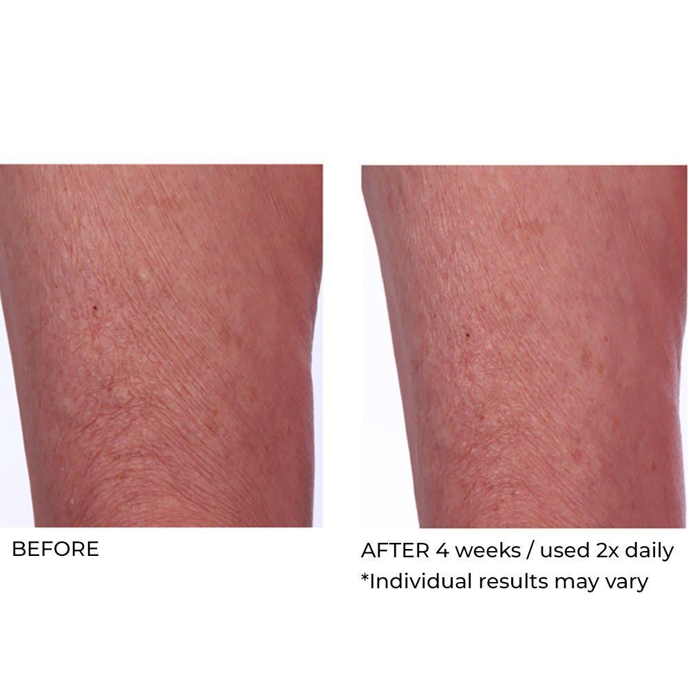 CREPE INHIBITOR TRIPLE ACTION BODY BUTTER