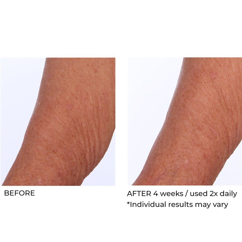 CREPE INHIBITOR TRIPLE ACTION BODY BUTTER