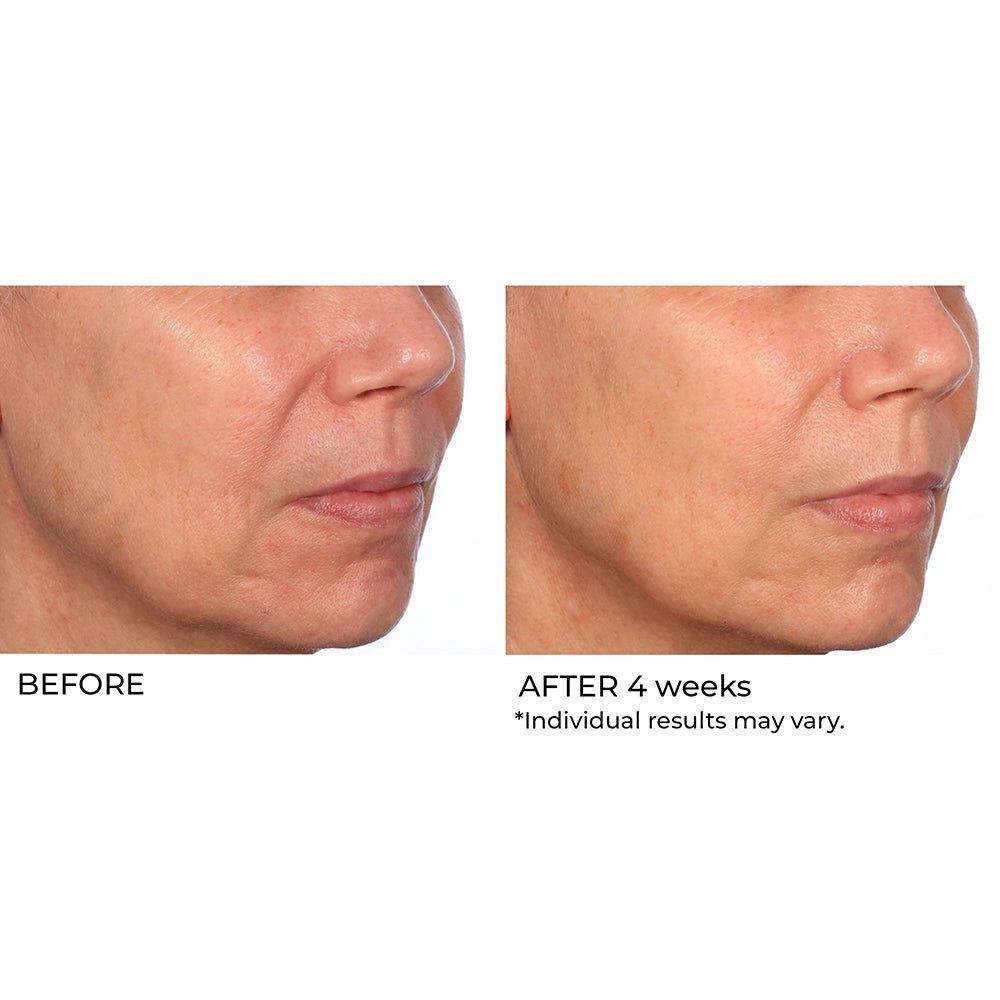 NassifMD Hydro-Gel serum ingredients