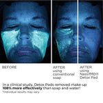 NassifMD Detox Pads before and after skin results