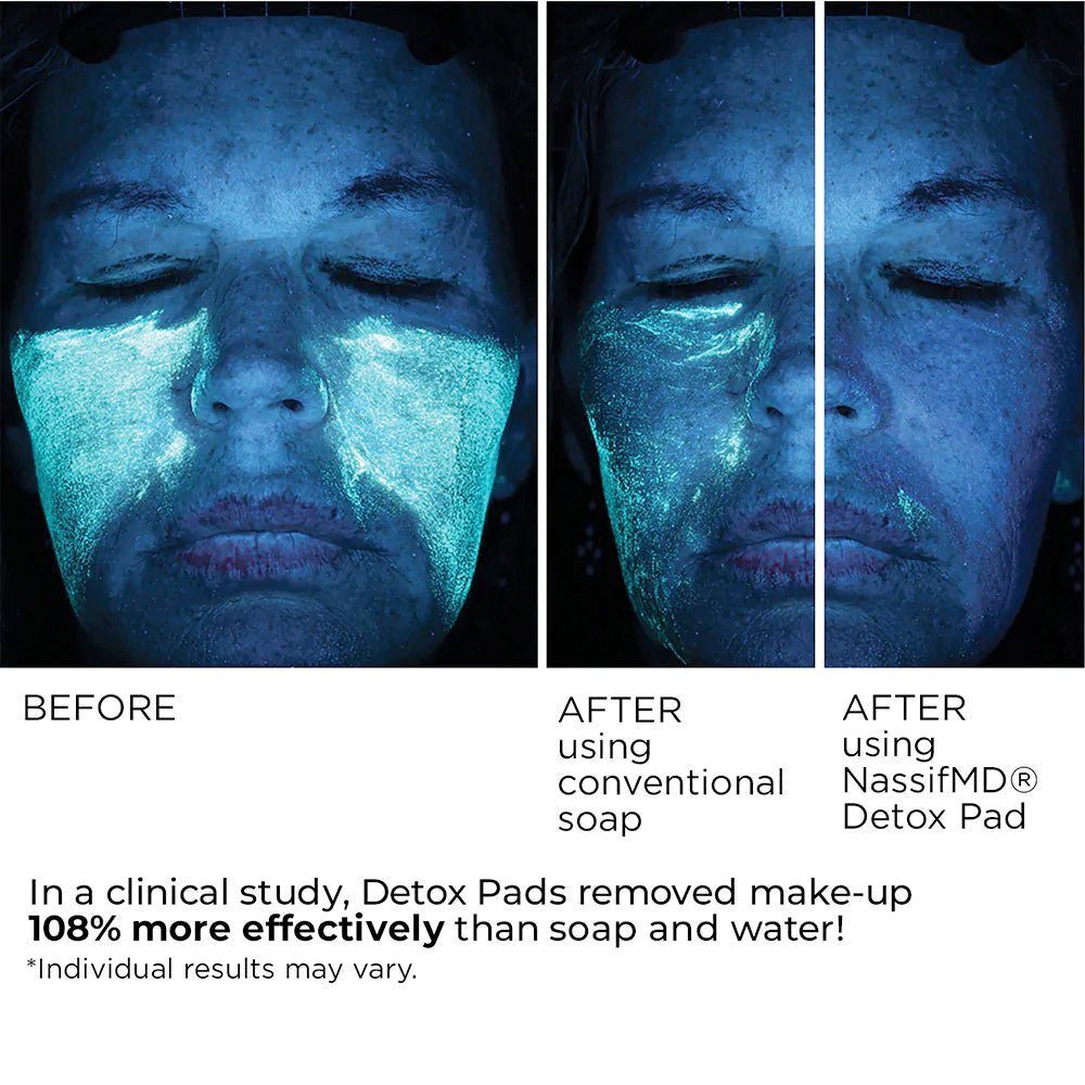 NassifMD Detox Pads before and after skin results