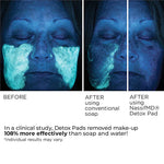 NassifMD Detox Pads application demonstration