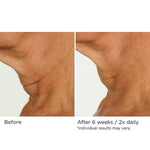 Deco-Lift Neck & Decollete Firming & Lifting Complex