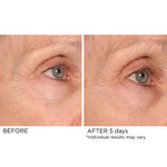 AGE DEFYING EYE RENEWAL SERUM