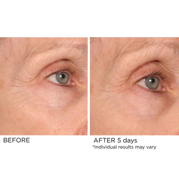 AGE DEFYING EYE RENEWAL SERUM