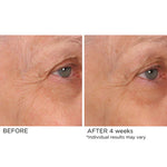 NassifMD Age Defying Eye Serum before and after 3