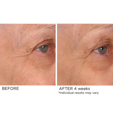 NassifMD Age Defying Eye Serum before and after 3