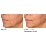 RADIANCE BRIGHTENING BOOSTER - Vitamin C Serum