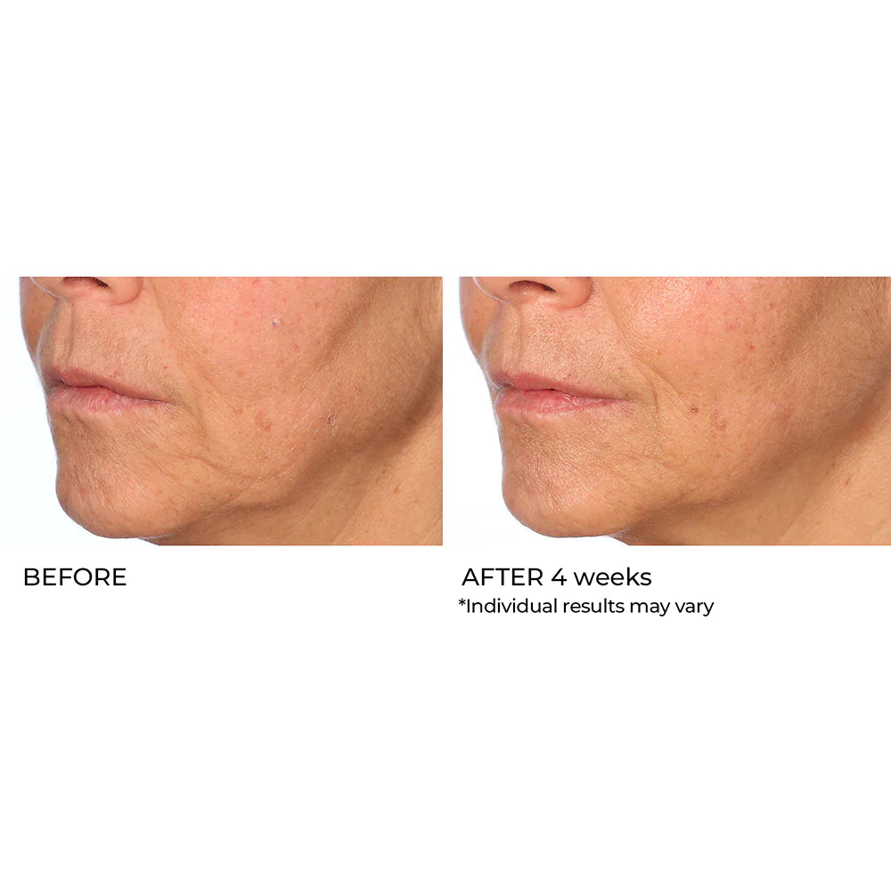 RADIANCE BRIGHTENING BOOSTER - Vitamin C Serum