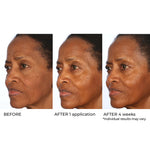 NassifMD Radiance Brightening Booster before and after result