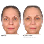 NassifMD Radiance Brightening Booster before and after 4 weeks