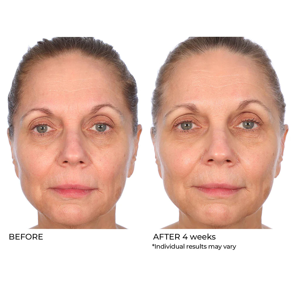 NassifMD Radiance Brightening Booster before and after 4 weeks