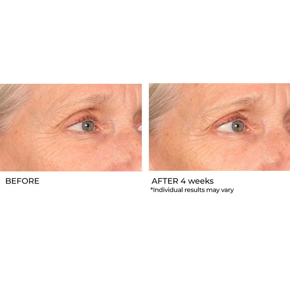 NASSIFMD® HYDRO-SCREEN® PRO PEPTIDE COLLAGEN SERUM with Hydraglucan® Peptide Complex