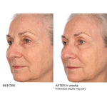 NASSIFMD® HYDRO-SCREEN® PRO PEPTIDE COLLAGEN SERUM with Hydraglucan® Peptide Complex