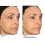 NASSIFMD® HYDRO-SCREEN® PRO PEPTIDE COLLAGEN SERUM with Hydraglucan® Peptide Complex