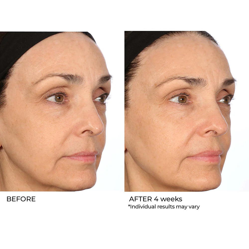 NASSIFMD® HYDRO-SCREEN® PRO PEPTIDE COLLAGEN SERUM with Hydraglucan® Peptide Complex