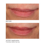 NassifMD Lip Sugar Scrub Pink Champagne texture