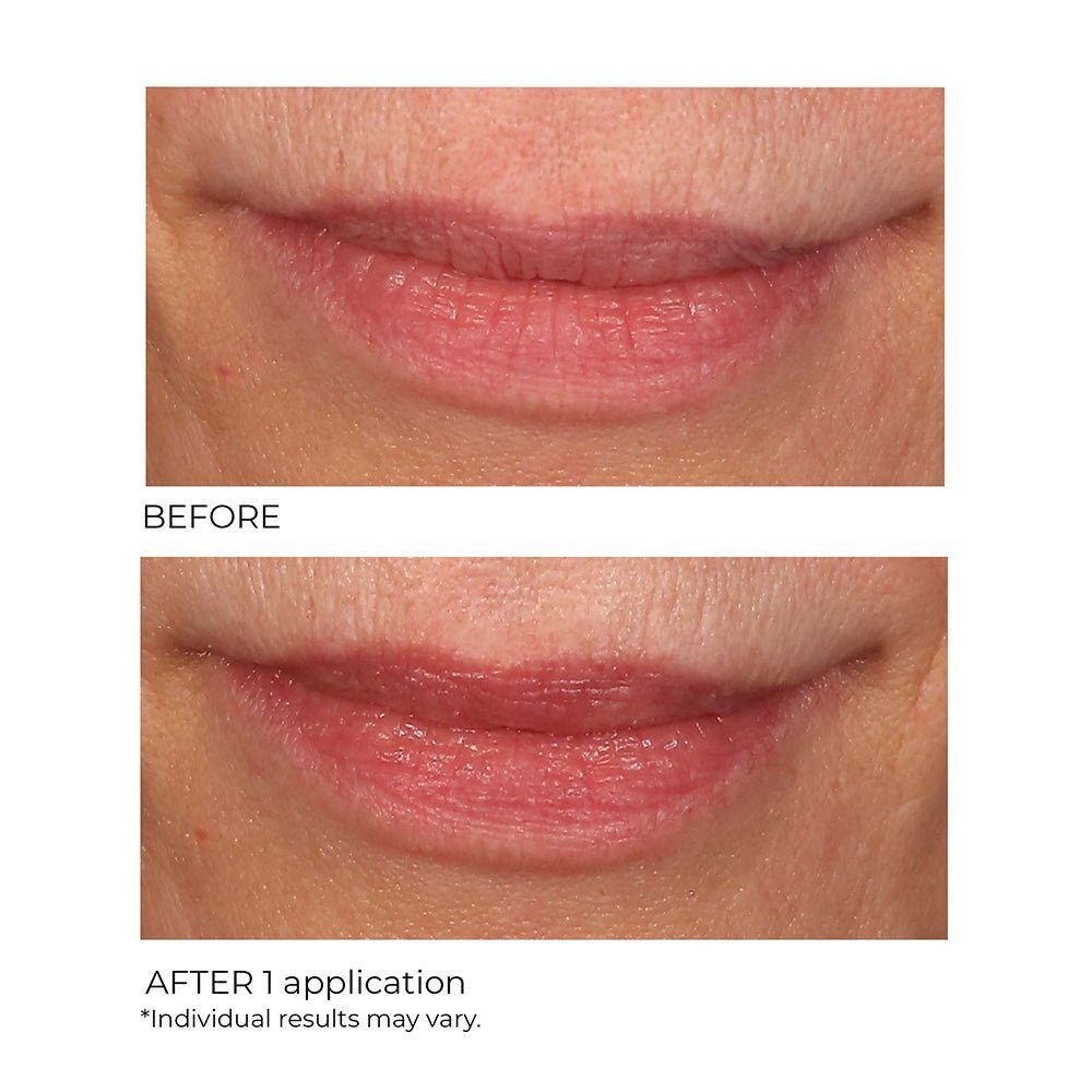 NassifMD Lip Sugar Scrub Pink Champagne texture