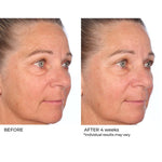 Restore & Firm Face Oil with CoQ10